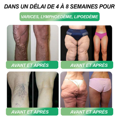 Plus que 10 boîtes ! HHVB®🎁 -30 % aujourd’hui ! Recommandée par les médecins : 4 à 6 boîtes pour éviter l’effet rebond. Dernière chance avant la nouvelle année ! 🎁